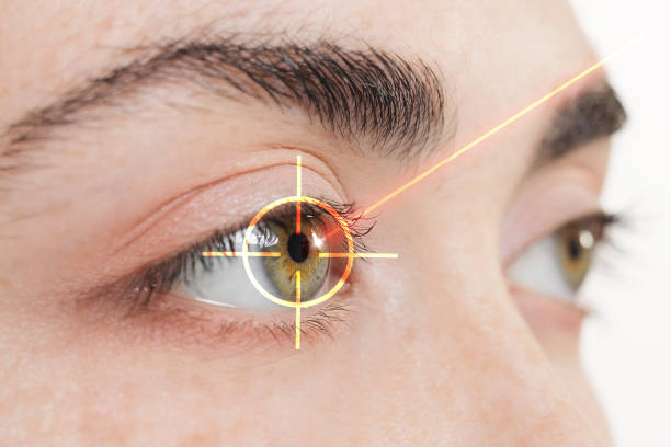 Explore the World of Lasik Laser Treatment for ... main image