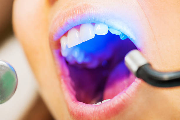 Embrace Dental Excellence: Discover the Best De... main image
