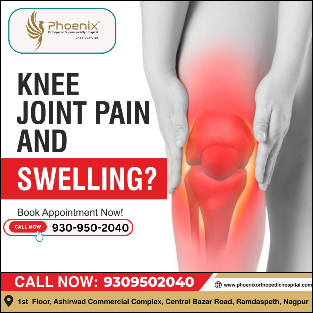 Joint swelling is the buildup of fluid in the s... main image