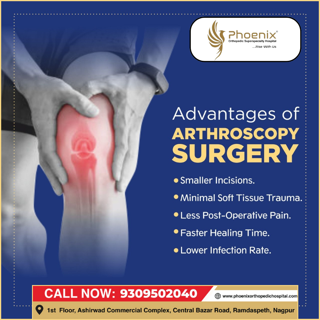 Arthroscopy is considered a minimally invasive ... main image