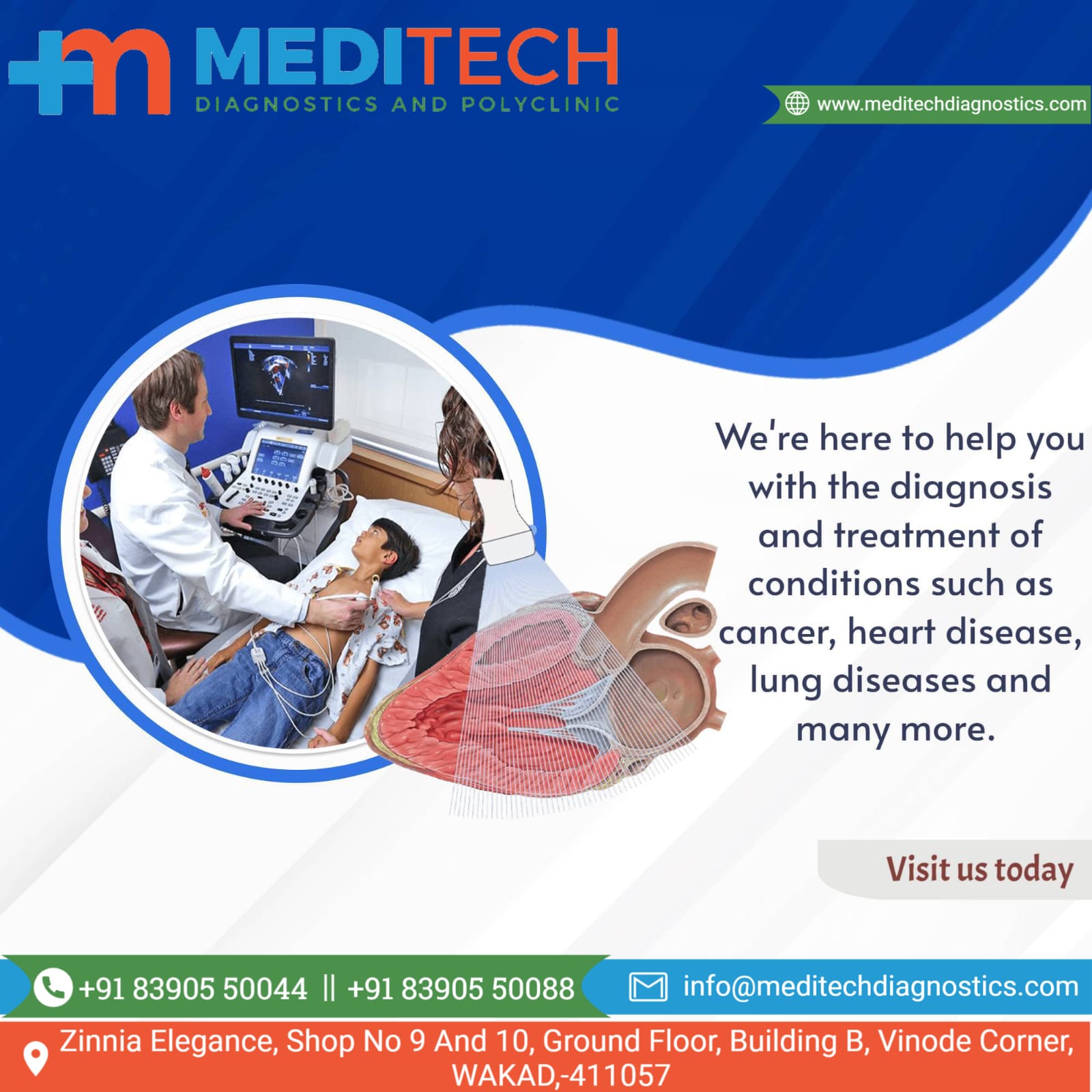 2D echocardiography, popularly called 2D echo, ... main image