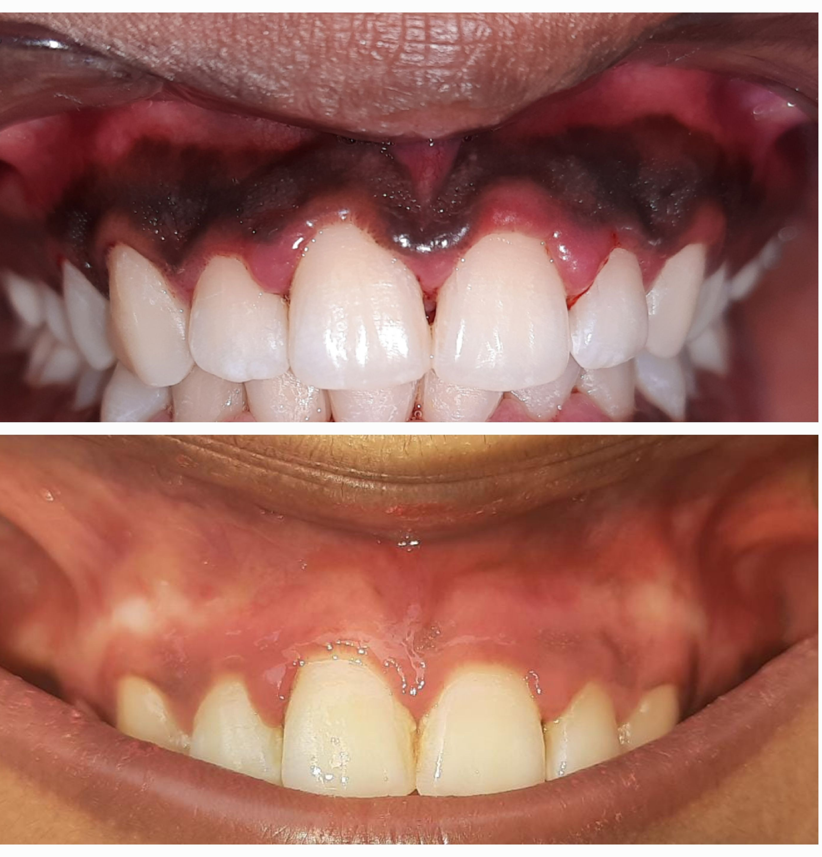 if you are conscious about your dark pigmented ... main image