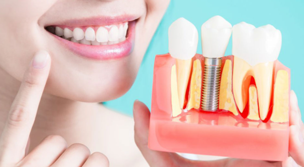 Dental Implant Surgery: Restoring Your Smile with ... main image