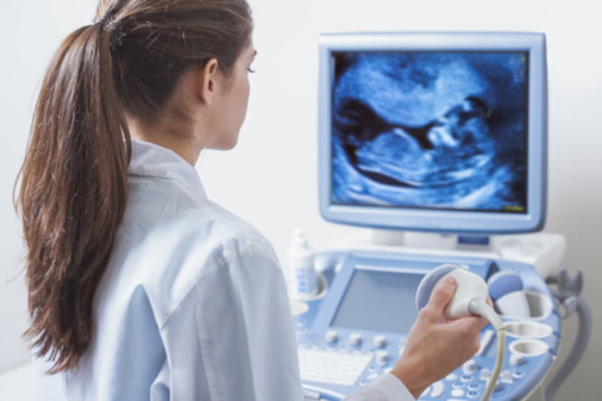 SONOGRAPHY: Precisio