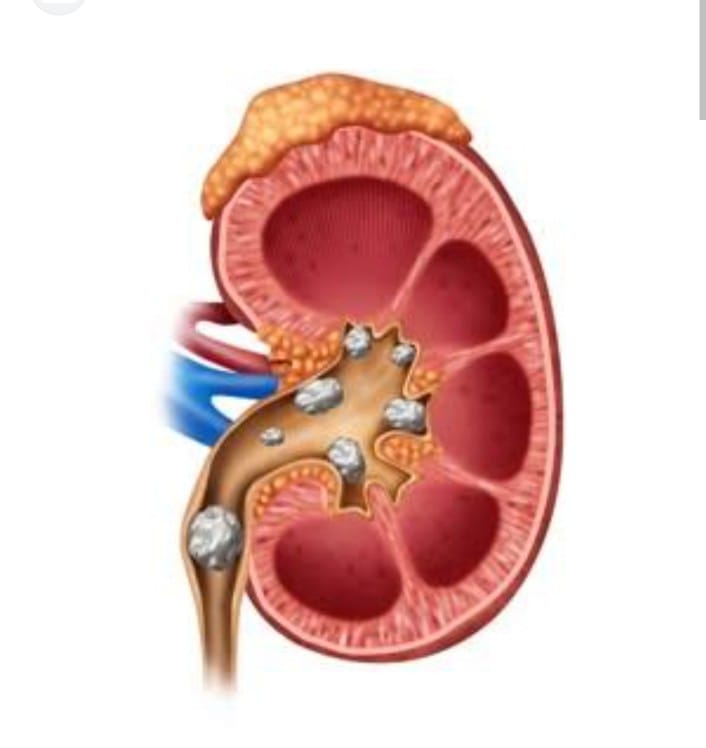 Integrity Hospital nephrology department is dedica... main image
