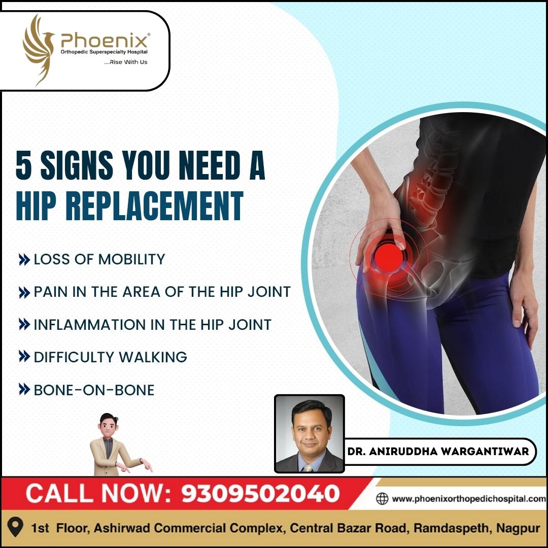 Is it time to consider a hip replacement? 🤔 Her... main image