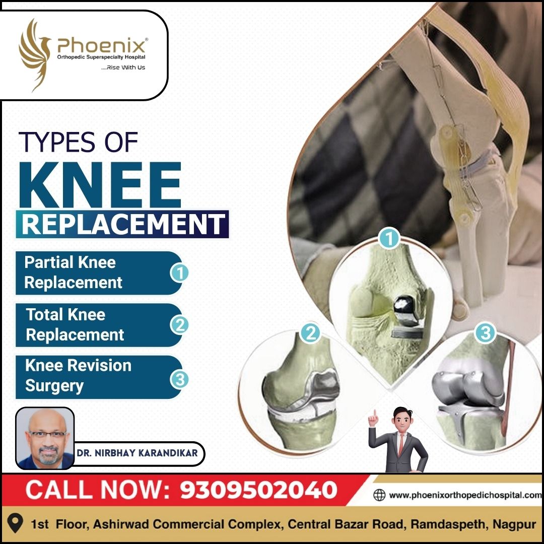 If you are experiencing a significant knee inju... main image