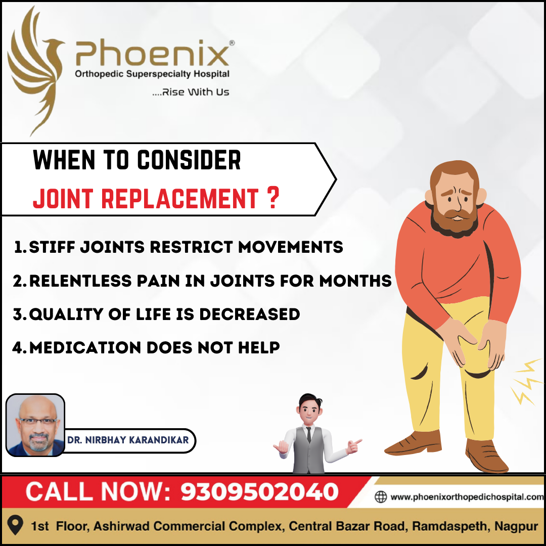 when to consider joint replacement? Consultants... main image