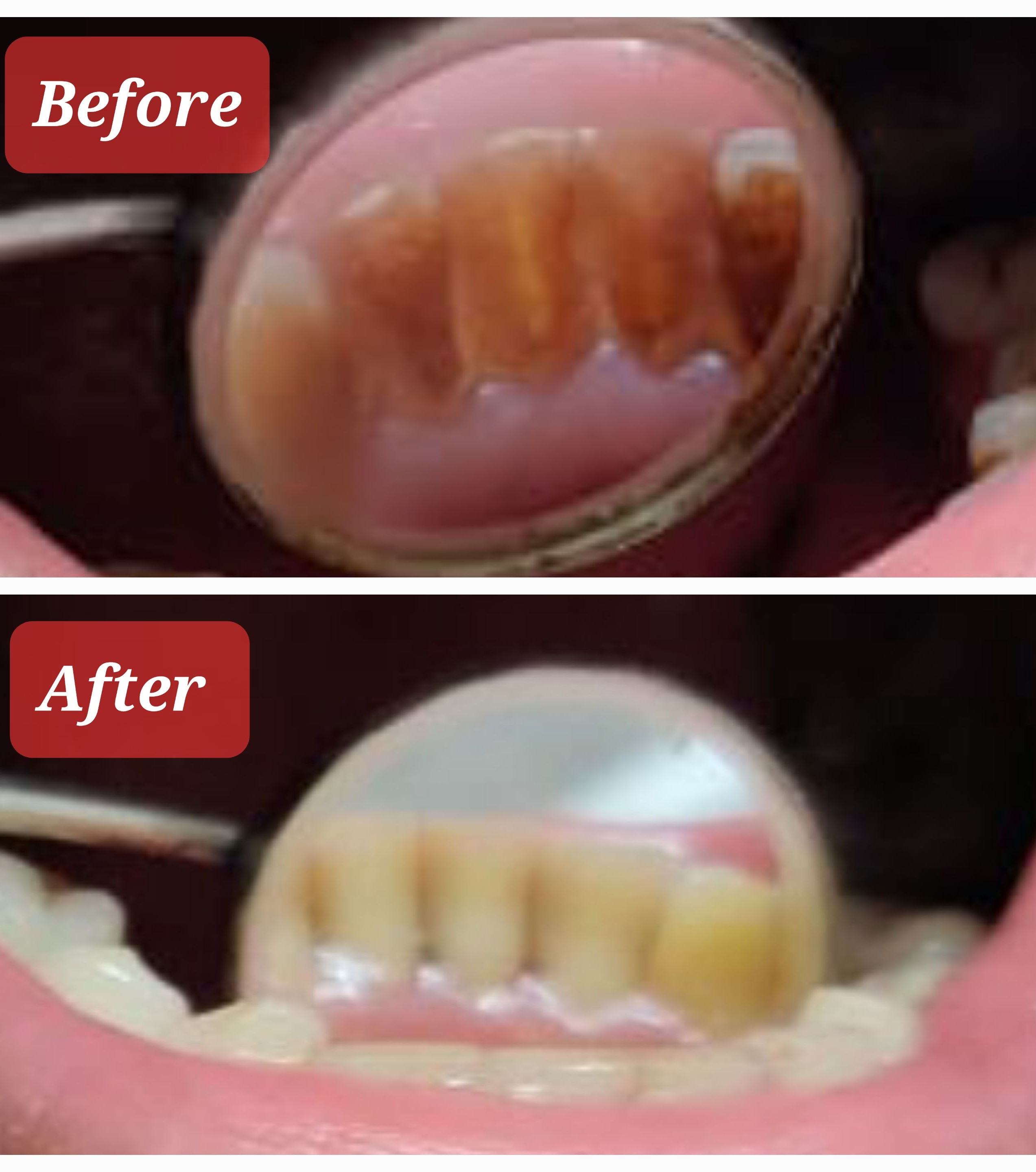 get your teeth cleaning done with ultrasonic sc... main image