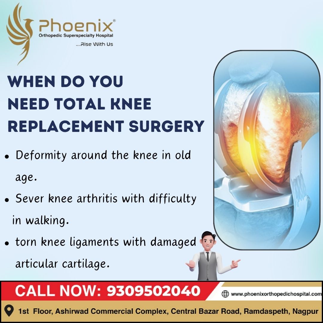 WHEN DO YOU NEED TOTAL KNEE REPLACEMENT SURGERY... main image