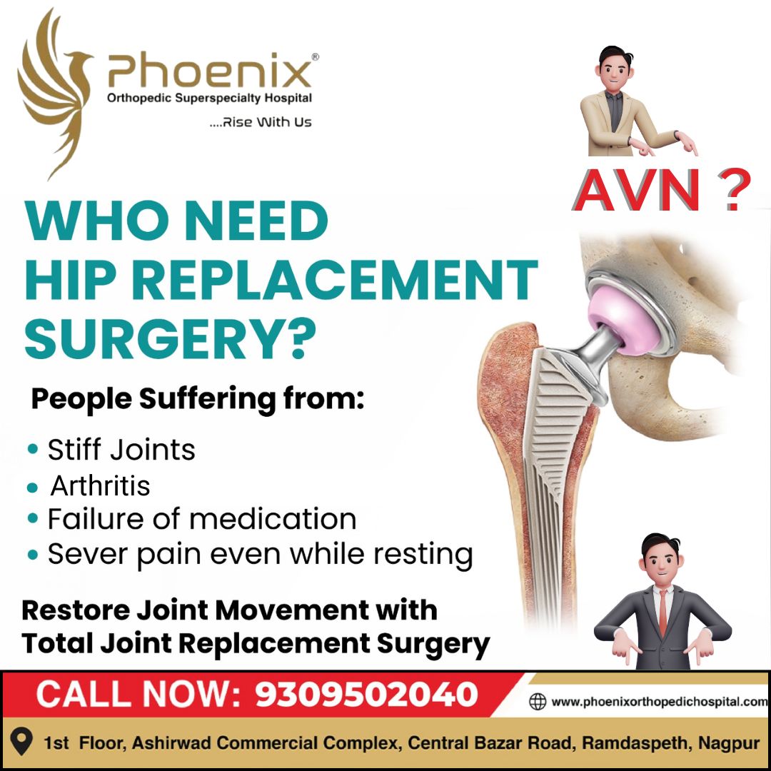 WHO NEEDS HIP REPLACEMENT SURGERY ? #bestsurgeo... main image