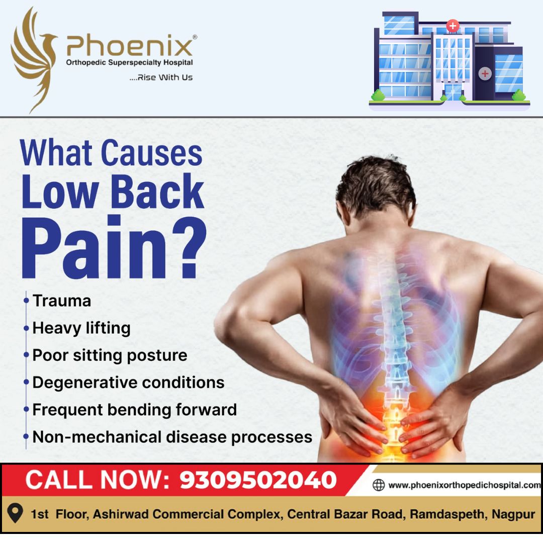 WHAT CAUSES LOW BACK PAIN ? #bestsurgeons #bestort... main image