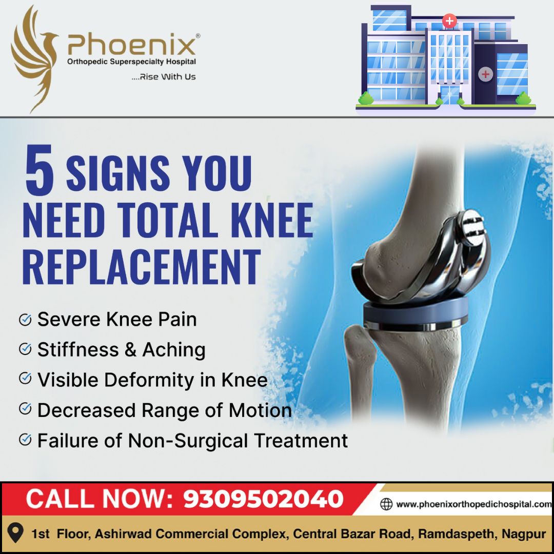 5 SIGNS YOU NEED TOTAL KNEE REPLACEMENT Consultant... main image