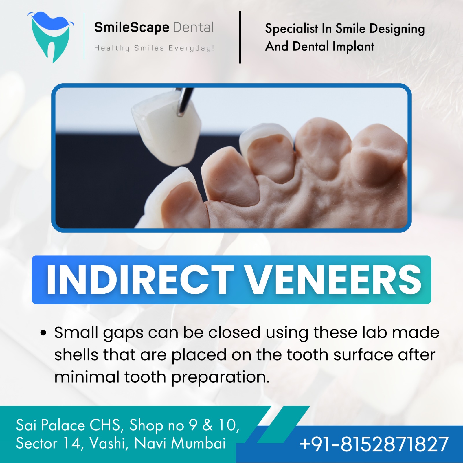 Mild Gaps between teeth can be unpleasant, unes... main image