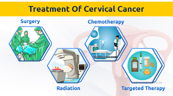 Treatment for Cervical cancer depends on severa... main image