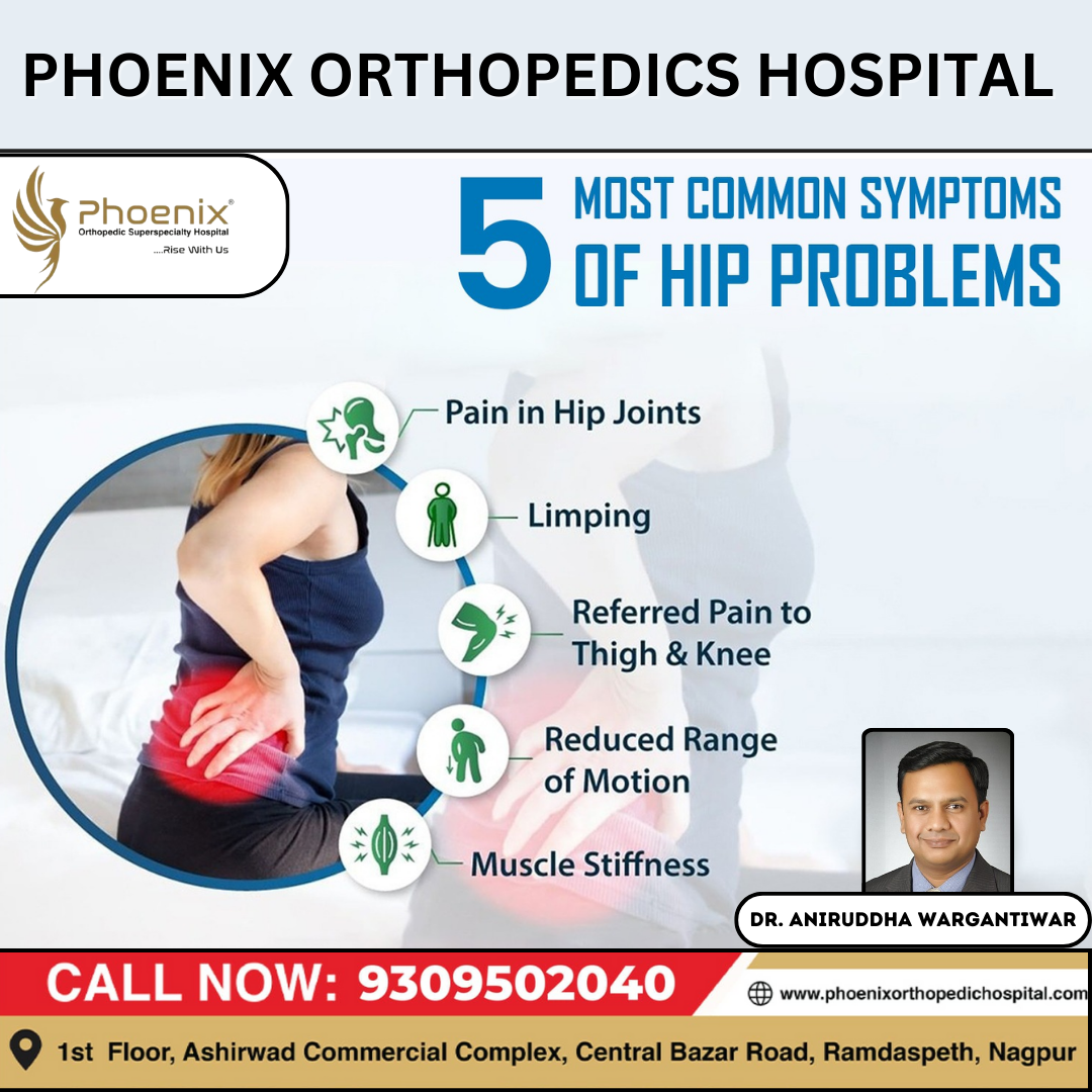 5 Most Common Symptoms Of Hip Problems Consulta... main image