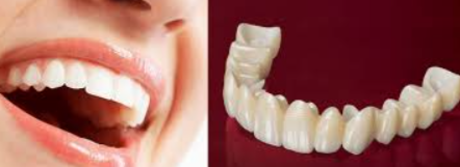 Zirconia Cap Treatments: Elevating Dental Aestheti... main image