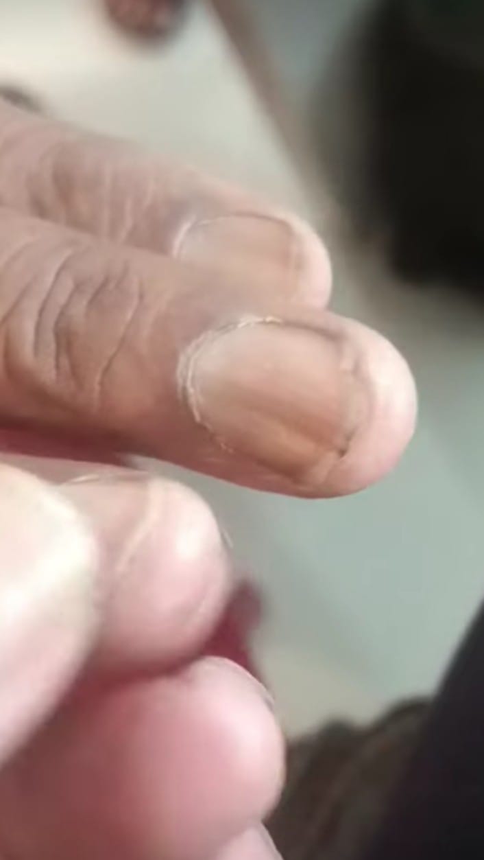 Nail findings can be indicative of various systemi... main image