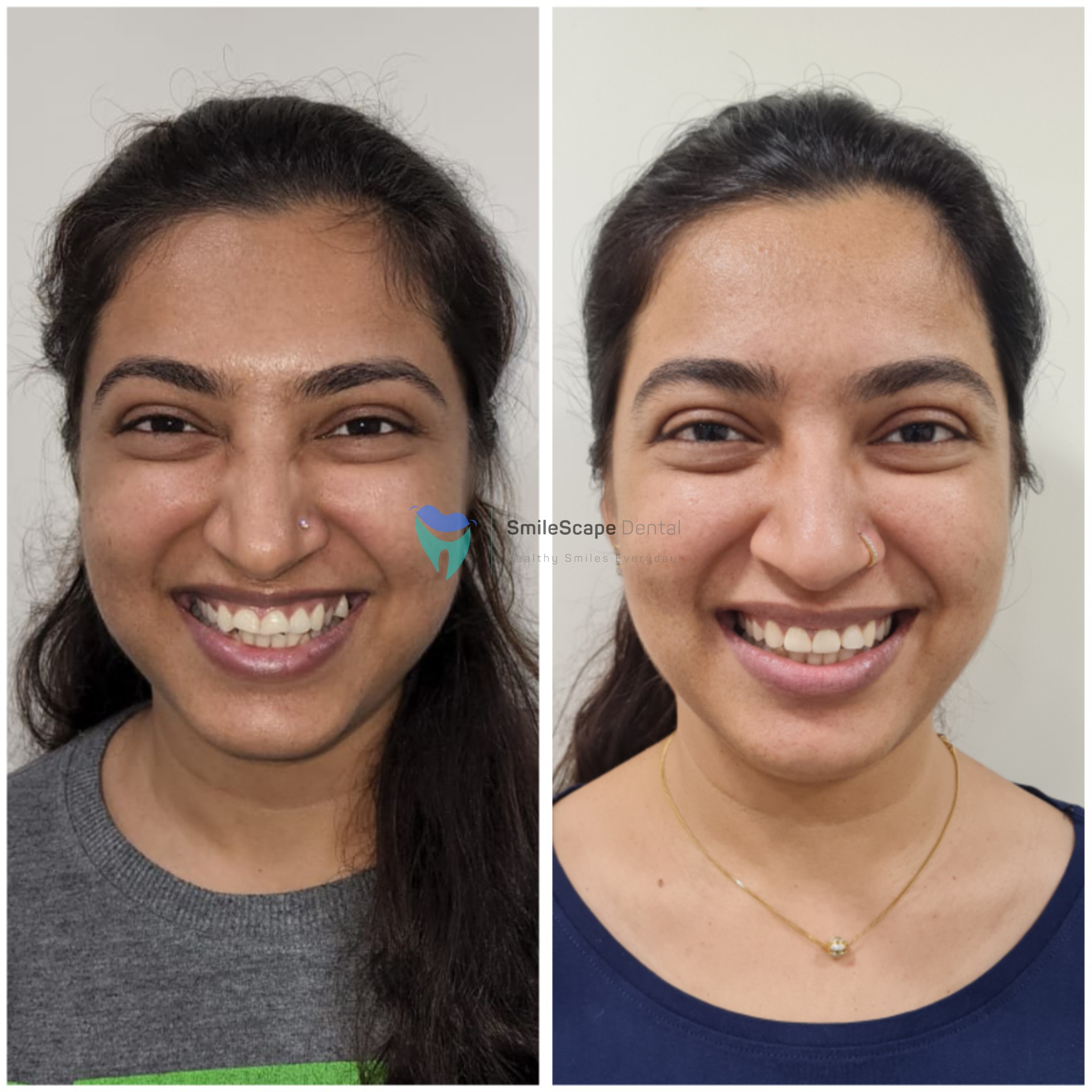 ORTHODONTIC TREATMENT and SMILE DESIGNING are p... main image