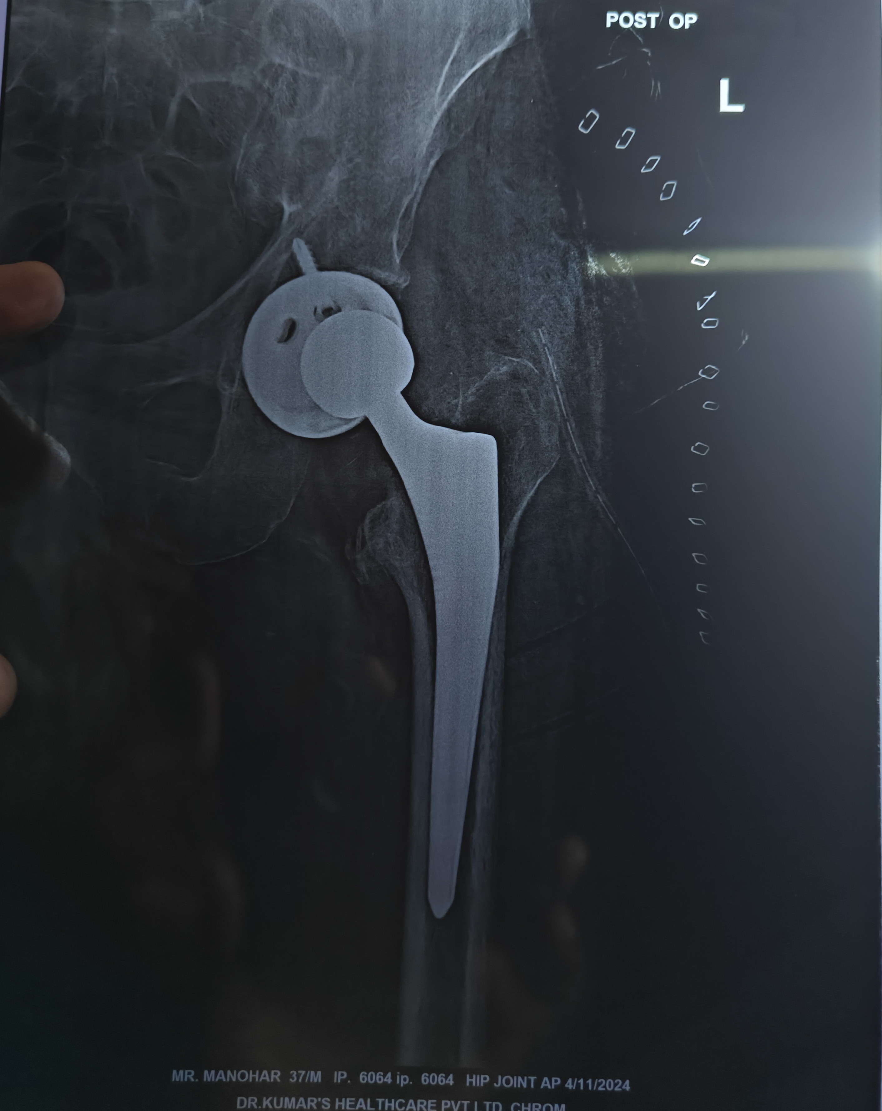 Physiotherapy clinic in Tambaram
Are you Looking f... main image