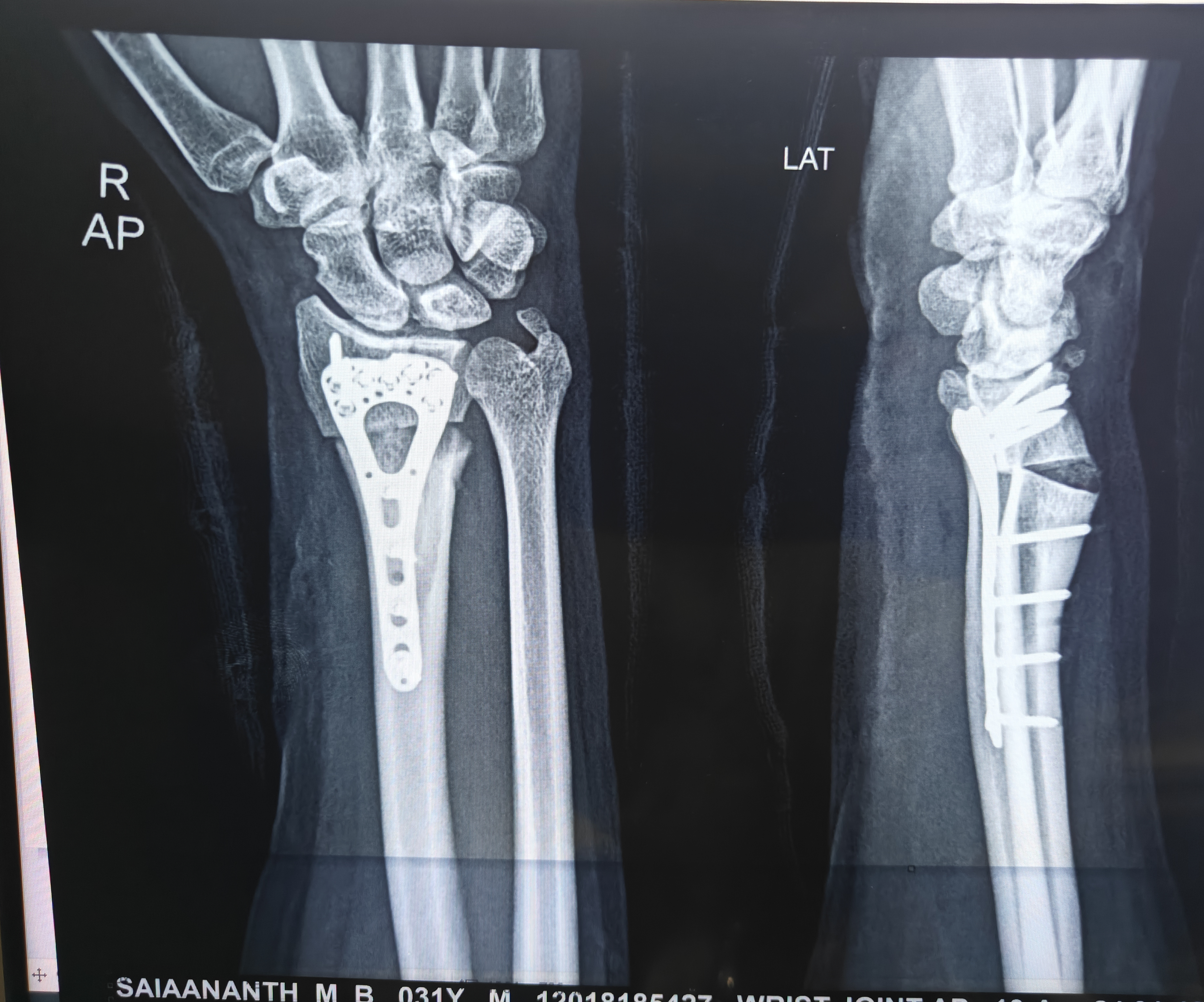 Physiotherapy clinic in Tambaram
Are you Looking f... main image