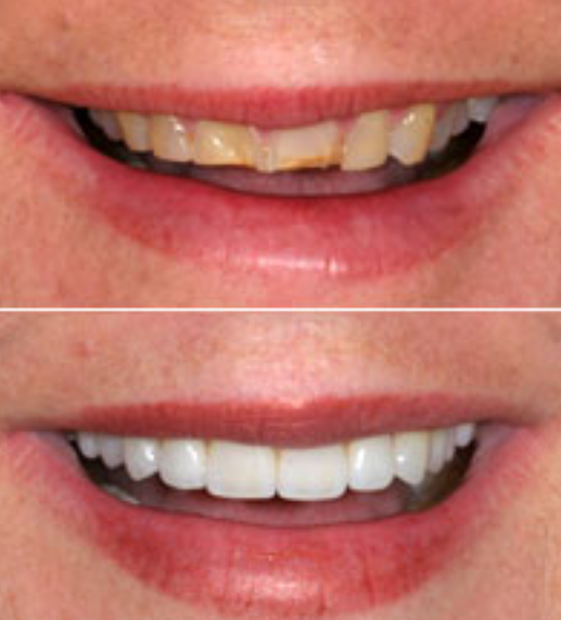 Revamp Your Smile wi