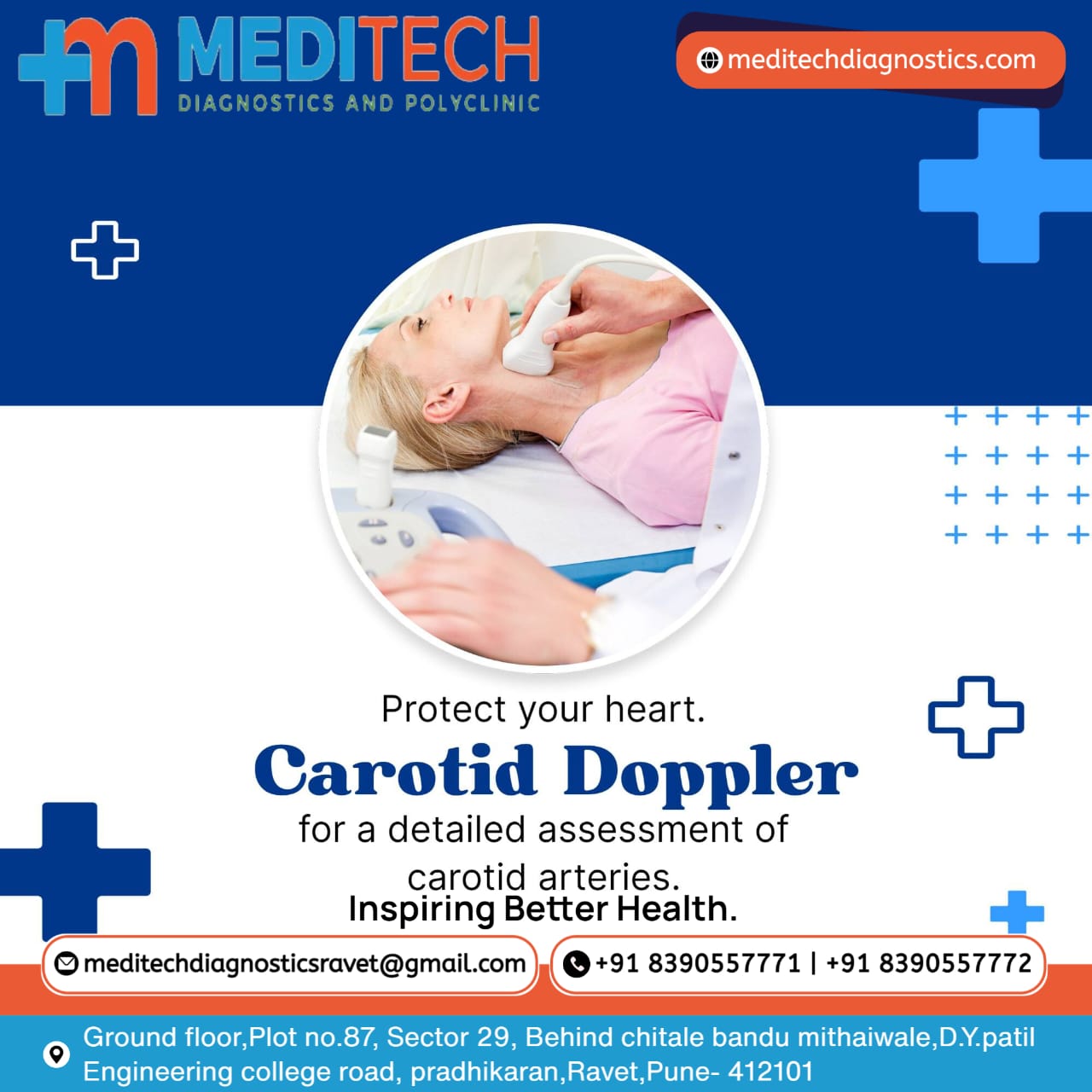 What is a Carotid Artery Doppler Ultrasound Exa... main image