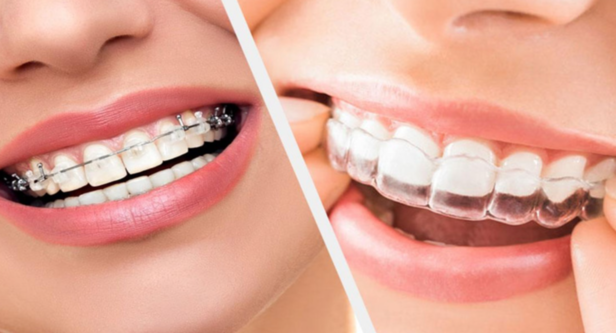 Transform Your Smile with Orthodontics Treatment a... main image