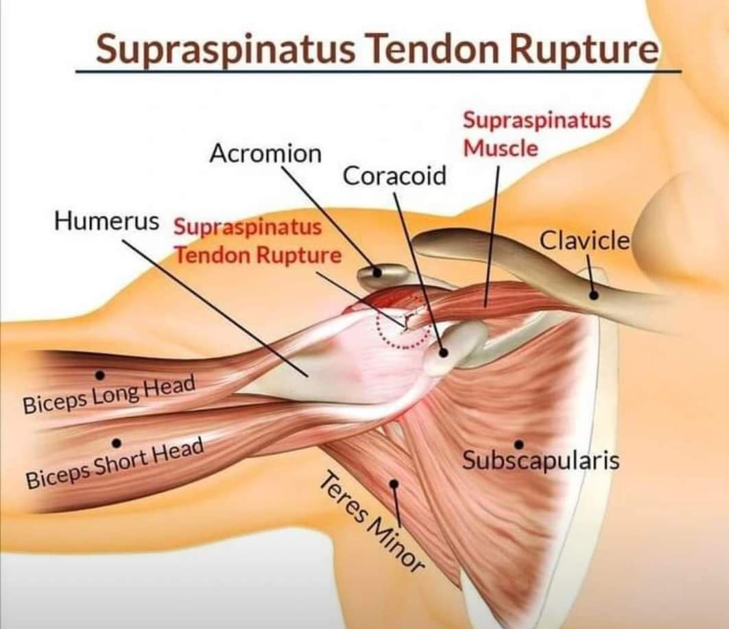 Physiotherapy clinic in Tambaram
Are you Lookin... main image