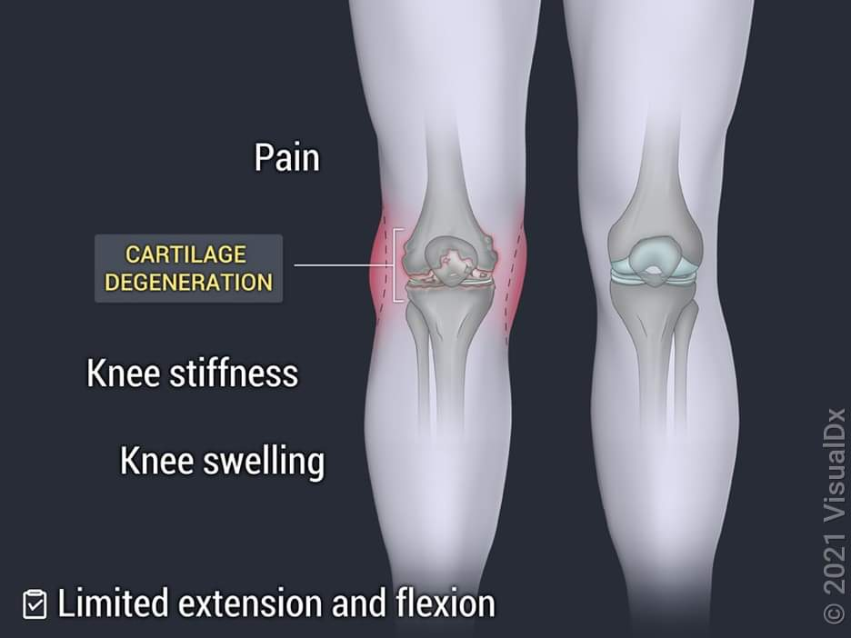 Physiotherapy clinic in Tambaram
Are you Lookin... main image