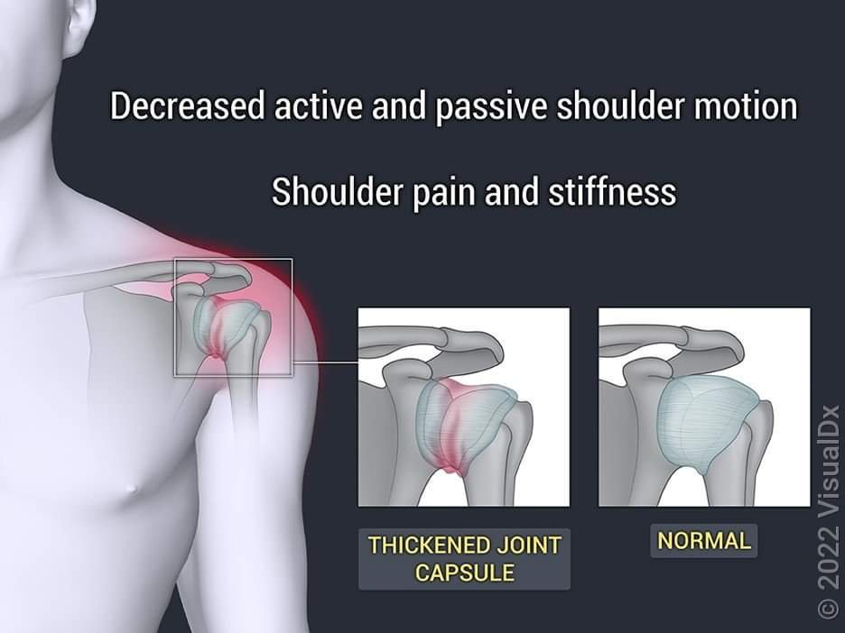 Physiotherapy clinic in Tambaram
Are you Looking f... main image