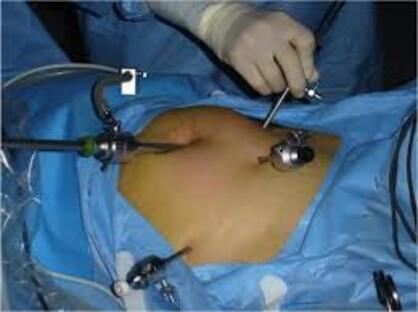 Laparoscopic Gynecological Procedures: Minimally I... main image