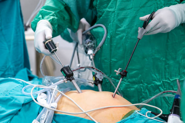 Advanced Laparoscopic Surgery Solutions Dr. Bin... main image