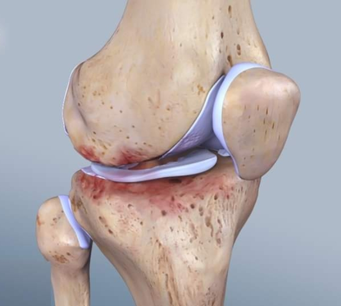 Physiotherapy clinic in Tambaram
Are you Looking f... main image