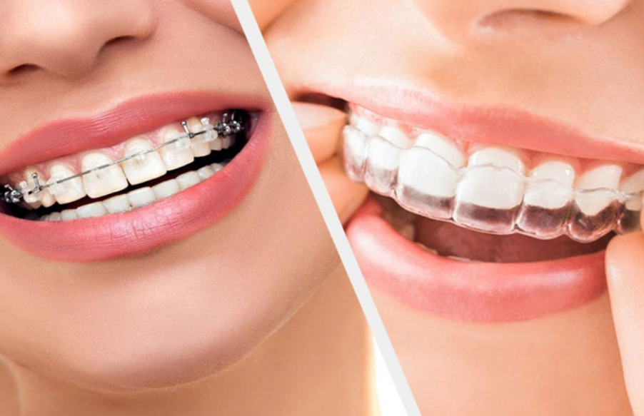 Transform Your Smile with Orthodontics Treatment a... main image