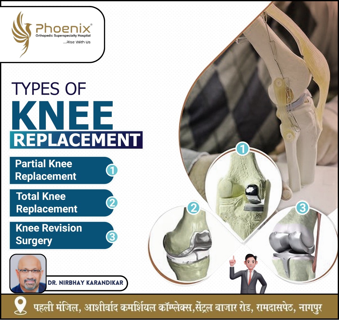 BEST ORTHOPEDIC HOSPITAL IN NAGPUR. TYPES OF KN... main image