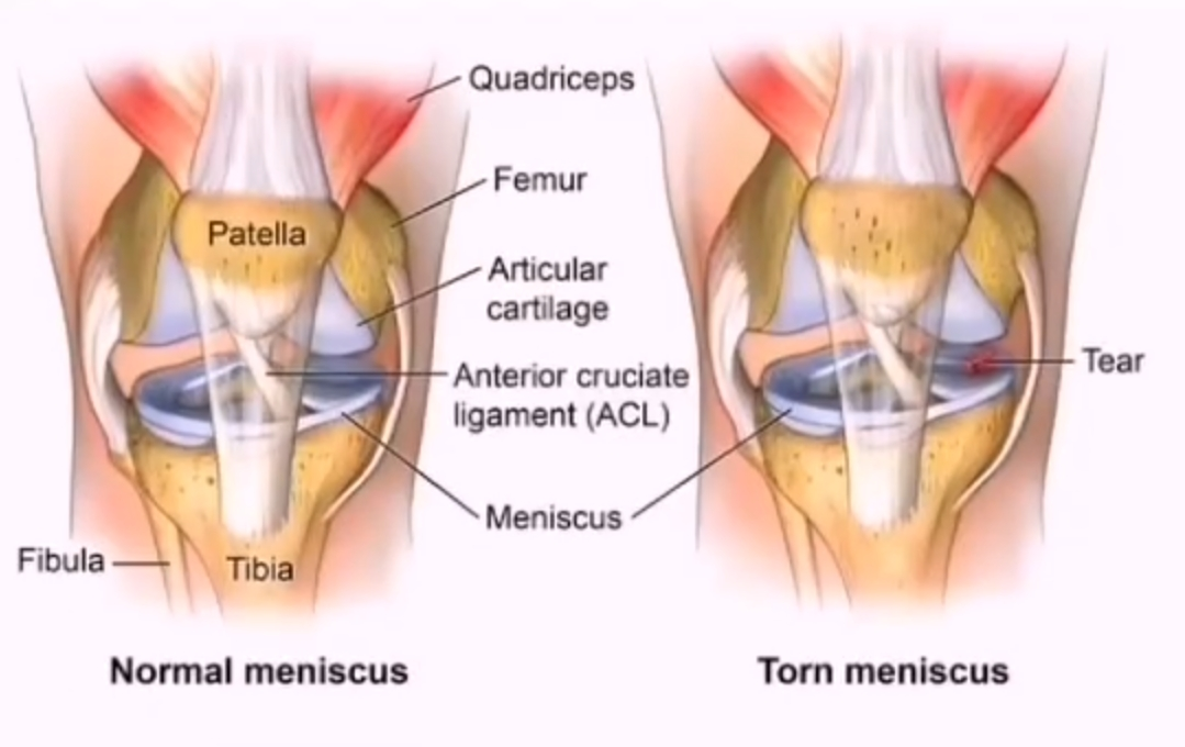 Physiotherapy clinic in Tambaram
Are you Lookin... main image