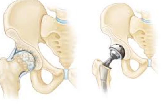 Orthopedic and Joint Replacement Surgery at Medino... main image