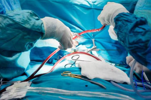 Unveiling Excellence: Beating Heart Bypass Surg... main image