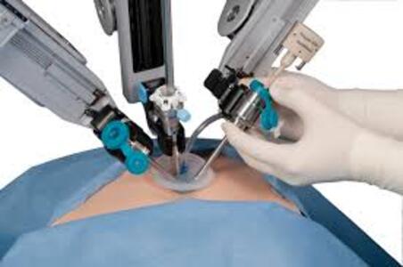 Specialized Laser and Robotic Surgery with Dr. ... main image
