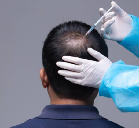 Advanced Hair Restoration at ELORAA CLINIQ Achi... main image
