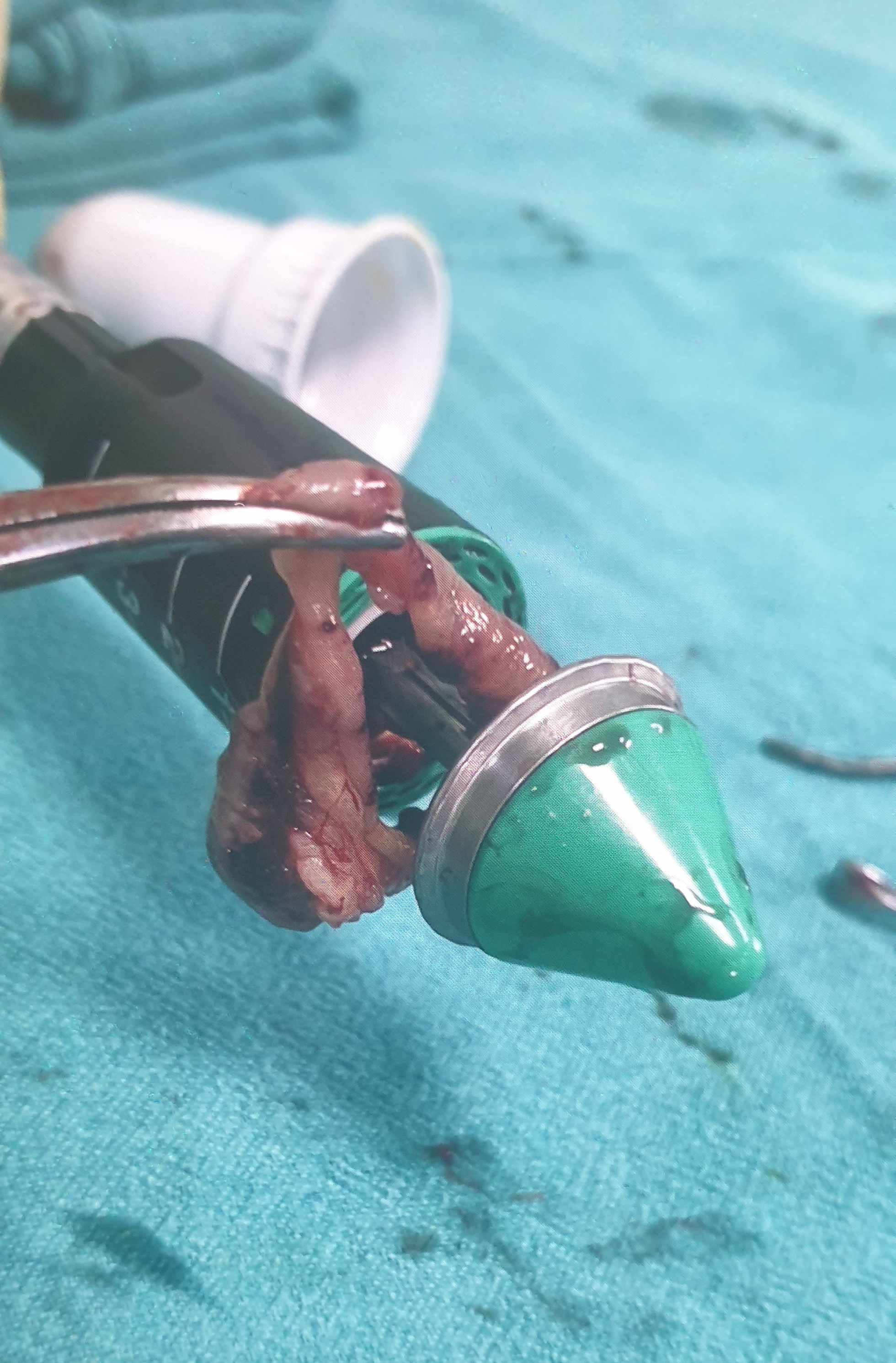 Best piles surgery 

Best surgical center in New D... main image