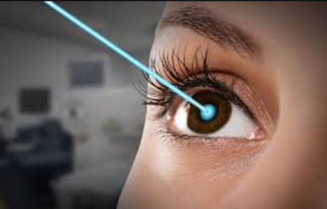 Laser Precision: Transforming Vision with Lasik... main image