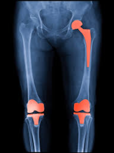 Best Orthopaedic in Rajkot: Vedant Hospital's Unma... main image