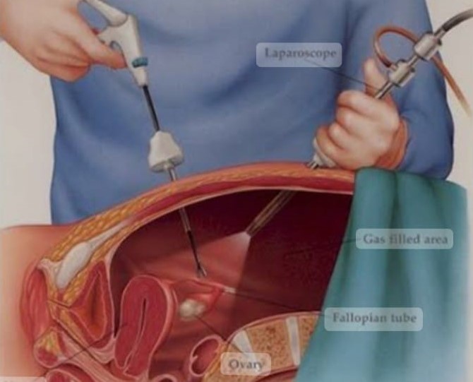 Advanced Laparoscopic Surgery at Integrity Hosp... main image