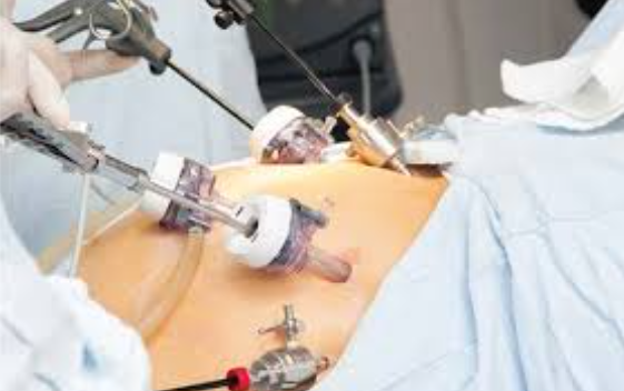 Leading Specialist in Key Hole Surgery: Dr. Raj... main image