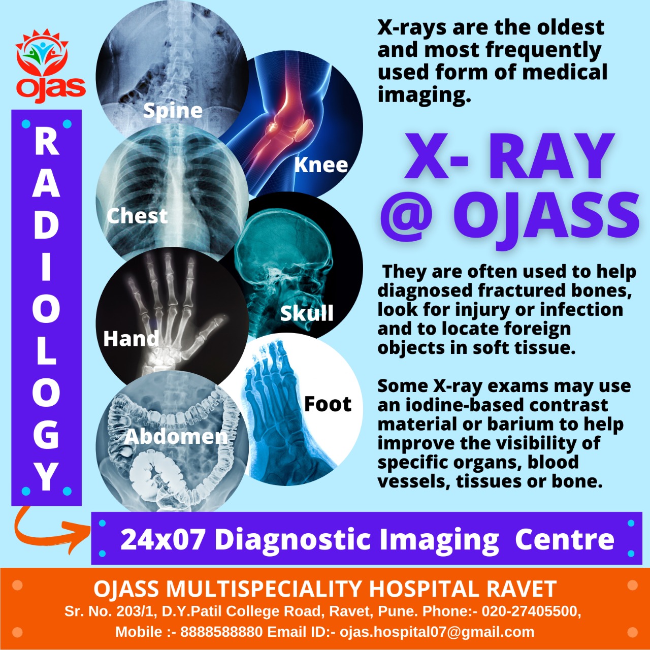 X-Ray, CT-Scan, USG is Available at Ojass Multi... main image