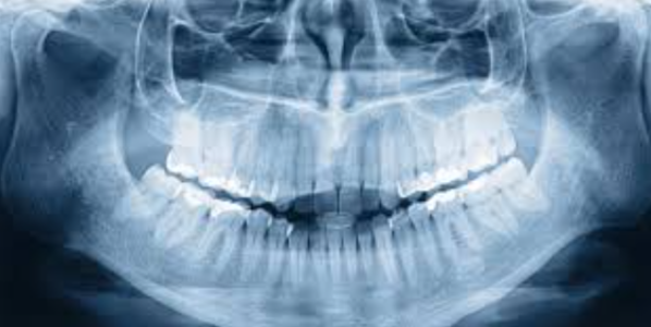 Insightful Care: Dental X-Ray Services at Medis... main image
