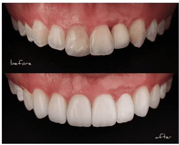 Best Veneers Doctor in Jaipur - Dr. Vaibhav Jain
... main image