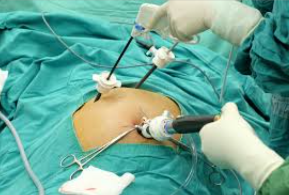 Expert Gall Bladder Surgeon: Dr. Rajiv Manek in... main image